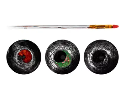 Philips Eagle Eye Platinum ST катетер ротационный