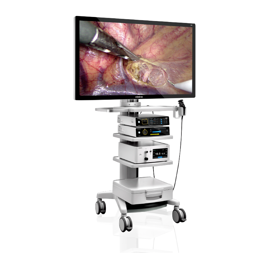 Жесткая эндоскопия