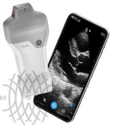 УЗИ аппарат GE HealthCare Vscan Air карманный