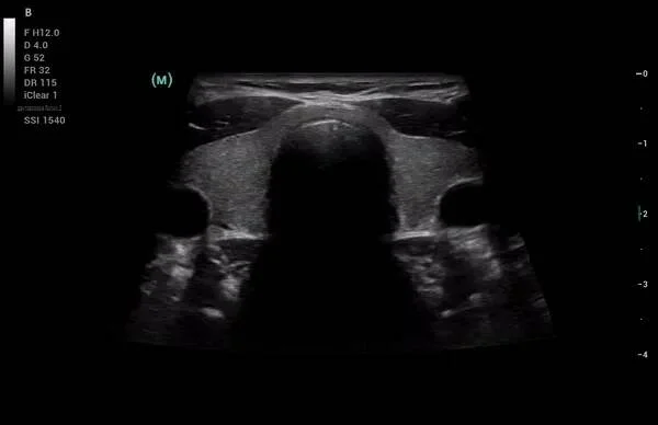 Клинические изображения УЗИ аппарат Mindray Consona N8