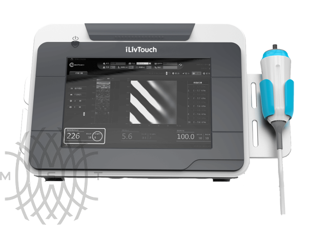 УЗИ аппарат iLivTouch FT 200