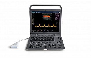 Sonoscape S8 Exp ультразвуковой аппарат