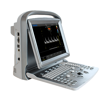 УЗИ аппарат Chison ECO 5