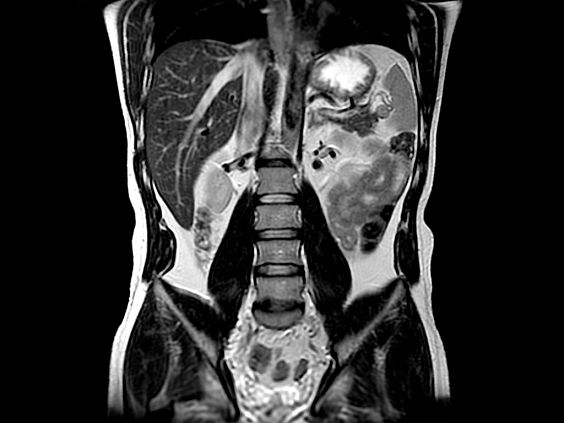  GE Healthcare Optima MR450w GEM Магнитно-резонансный томограф