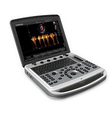 Chison SonoBook 8 ультразвуковой аппарат