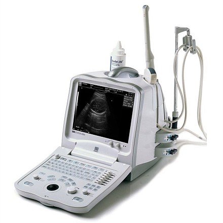 УЗИ аппарат Mindray DP 6600
