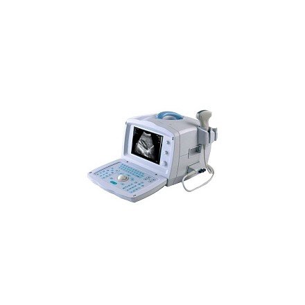 УЗИ аппарат Mindray DP 1100
