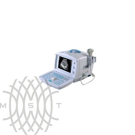 УЗИ аппарат Mindray DP 1100