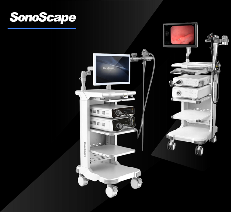 SonoScape