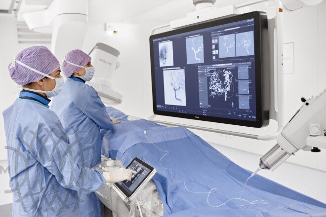 Philips Azurion 7 B20/15 ангиограф