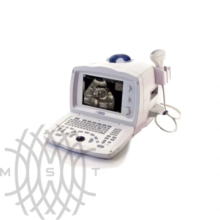 УЗИ аппарат Mindray DP 2200