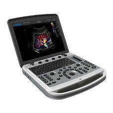 Chison SonoBook 9 ультразвуковой аппарат