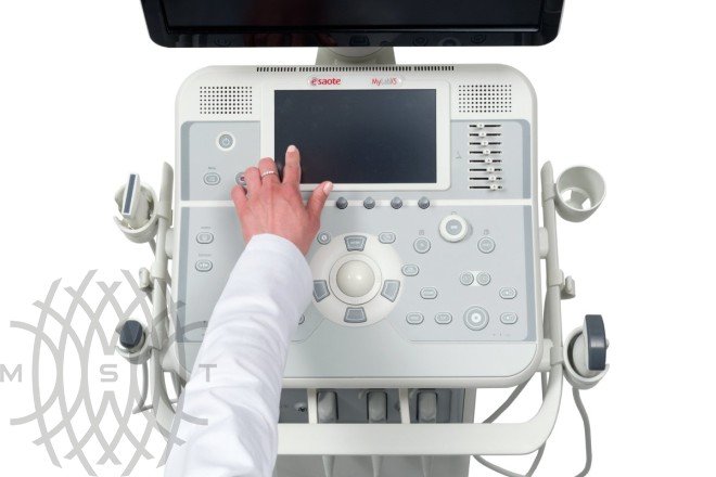 УЗИ аппарат Esaote MyLab X5