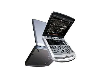 УЗИ аппарат Chison SonoBook 6 портативный