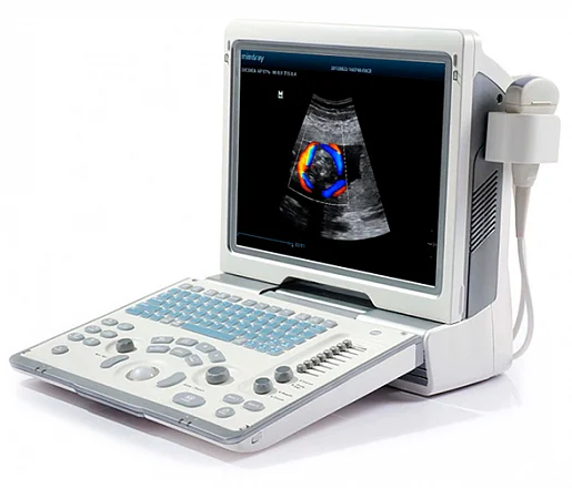 Mindray DP-50 Color портативный аппарат УЗИ Mindray DP-50 Color портативный аппарат УЗИ