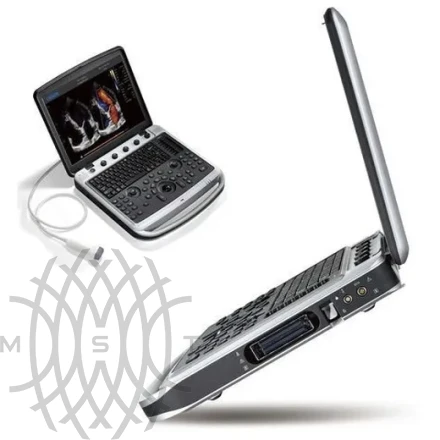 УЗИ аппарат Chison SonoTouch 80 Expert портативный