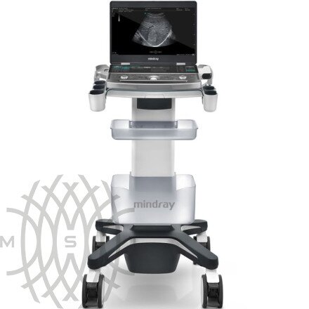Mindray MX7 ультразвуковой аппарат портативный