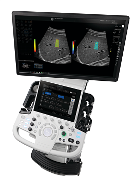 Ультразвуковой аппарат GE HealthCare Logiq P10