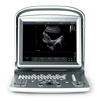 УЗИ аппарат Chison ECO 5