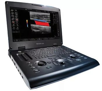 Портативный ультразвуковой аппарат GE Versana Active